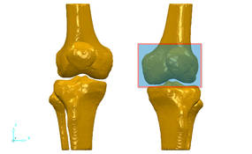 3D data of knee joint